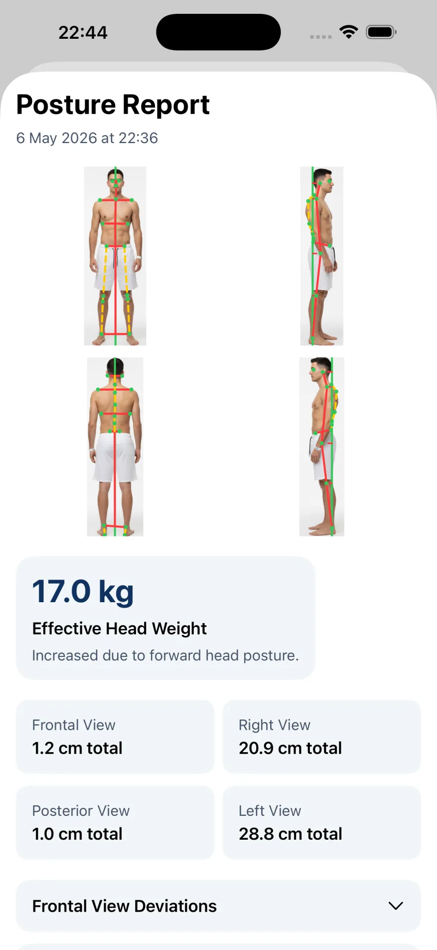 PostureSync posture report in the PhysioSync app, showing the four views and measurements