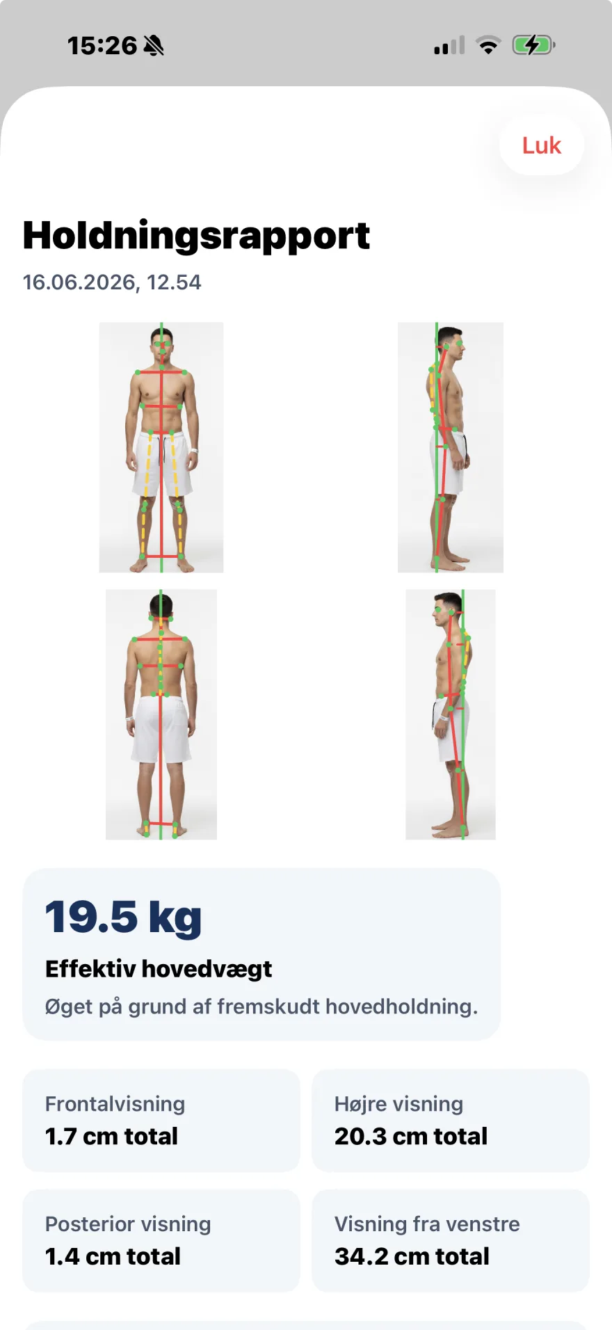 PostureSync holdningsrapport i PhysioSync-appen, der viser de fire vinkler og målinger