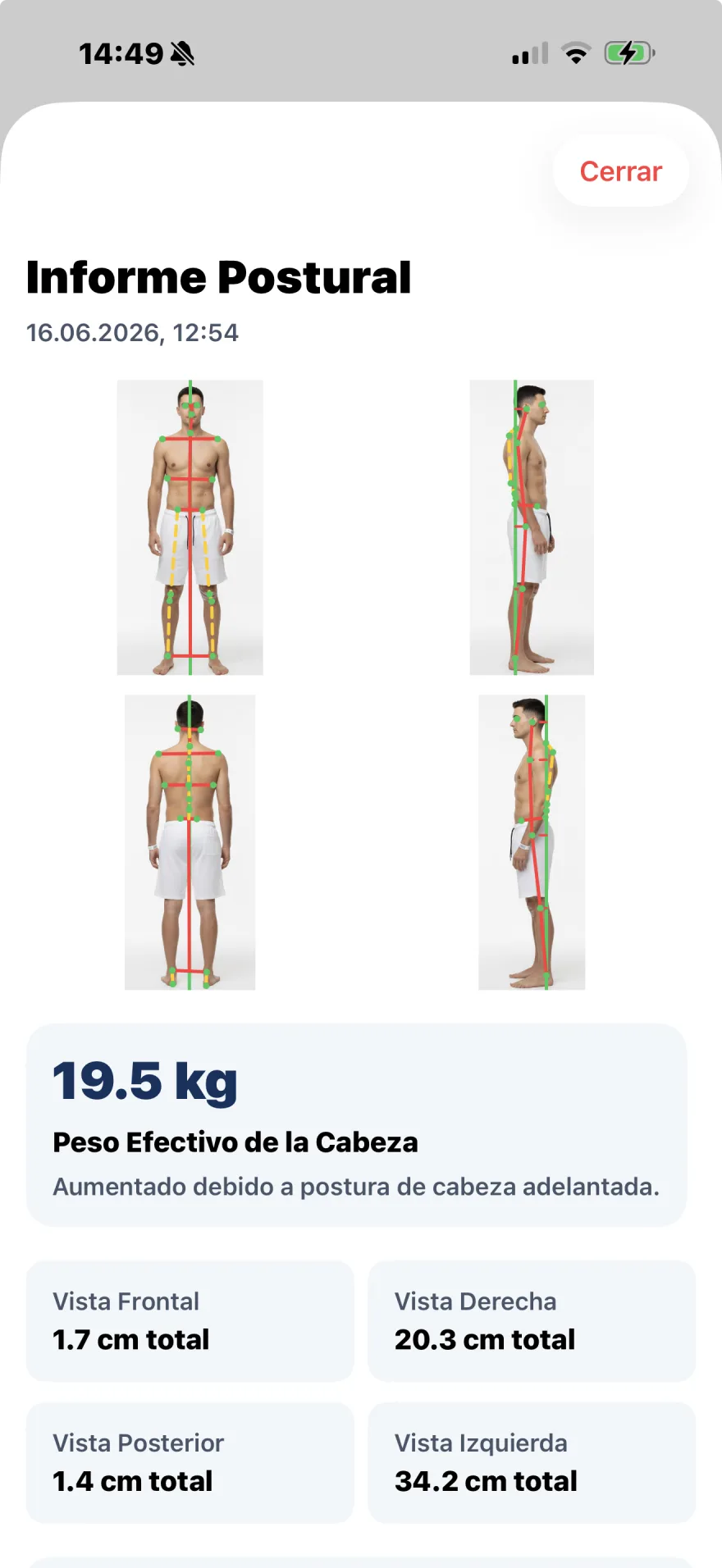Informe de postura PostureSync en la app PhysioSync, con las cuatro vistas y mediciones