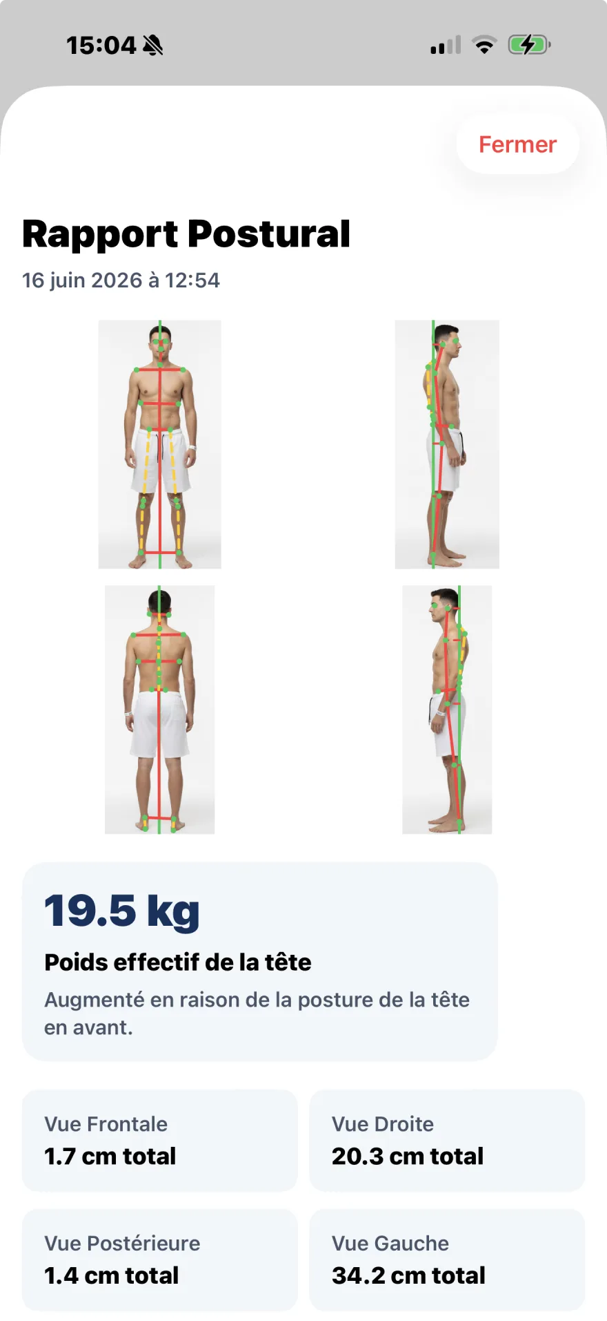 Rapport de posture PostureSync dans l'app PhysioSync, avec les quatre vues et les mesures