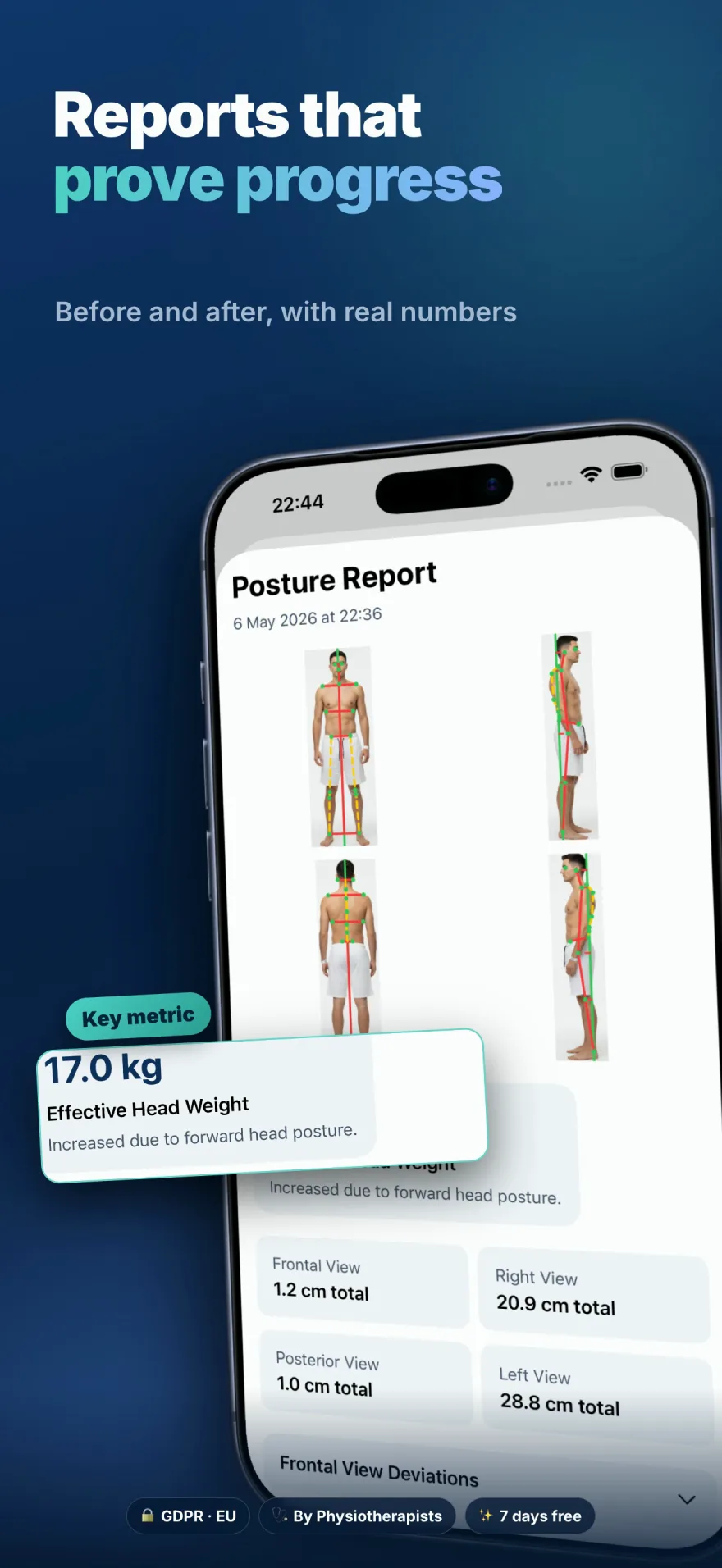 Posture report with before/after metrics
