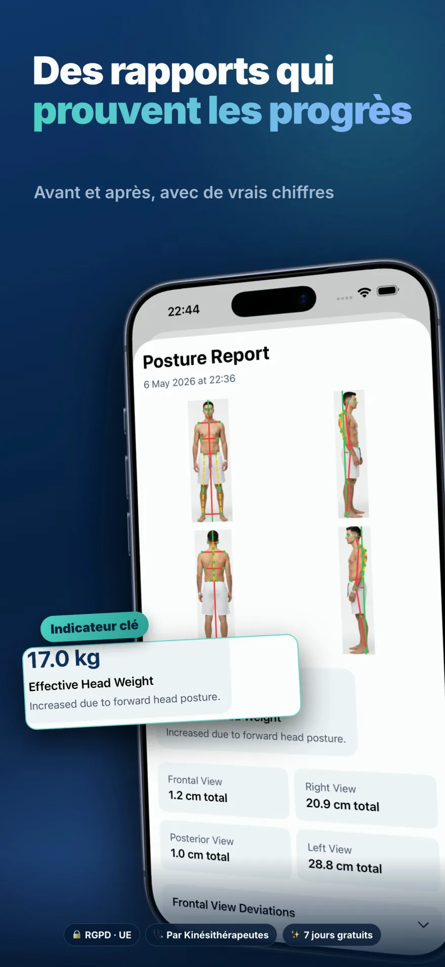 Rapport de posture avec mesures avant/après